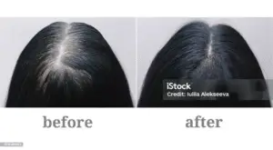 THINGS I TRIED TO PREVENT HAIR FALL wx1e2l0m